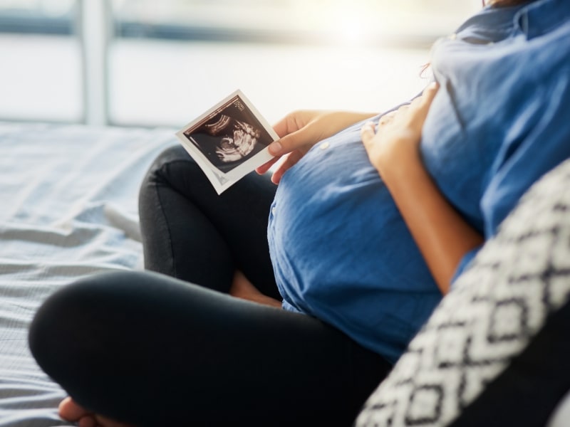 Pregnant woman looks at ultrasound photo